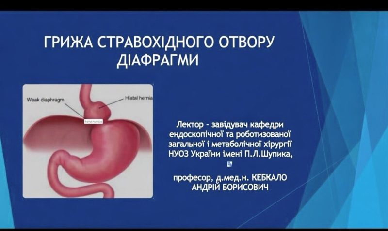 Грижа стравохідного отвору діафрагми