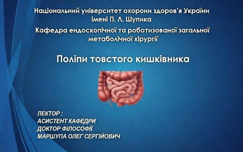 Онлайн-лекція: Поліпи товстого кишківника