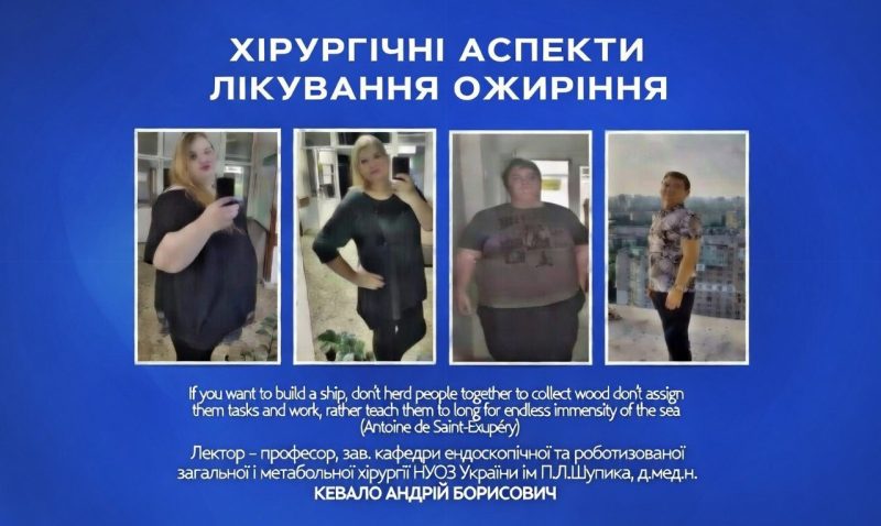 Онлайн-запис лекції «Хірургічні аспекти лікування ожиріння» професор Кебкало А.Б.